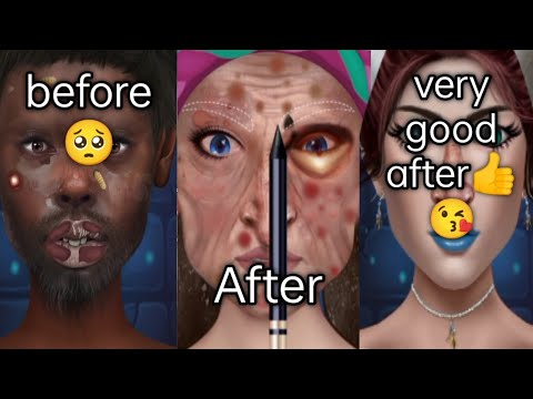 ASMR Care Animation Collection5 | Ohrschuhentfernung, durchdringende Reinigung, Talg, Schwarzkopf, Rasur, Stye