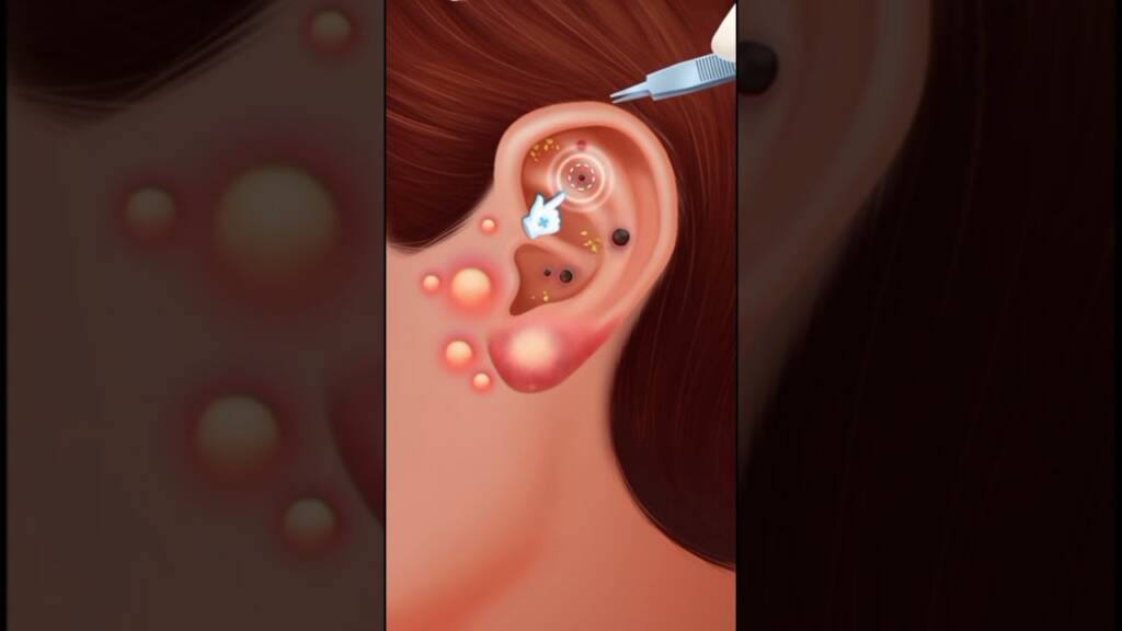 ASMR Warum Pflege nach Piercing 2 Piercing Cleaning Animation | Durchdringende Reinigung