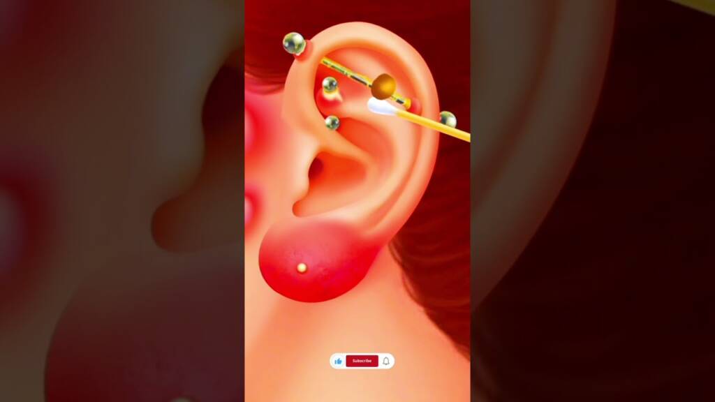 ASMR Ohr -Piercing Pus | Squeeze Ohr Acne Life Care TV1 quetschen