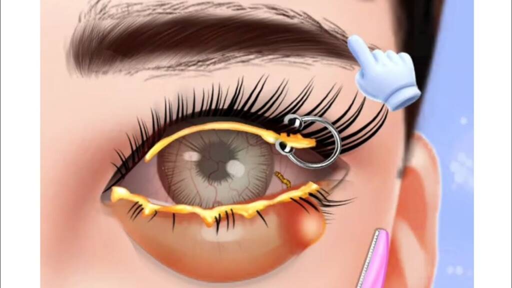 ASMR Eye Piercing Care#YouTube Video#Care#Trending