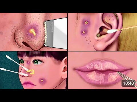 ASMR Seltsamerweise befriedigende Pflegeanimation‼ ️ Piercing Reinigung, Nasensebum, Lippenpflege, Make -up | Nasensebum