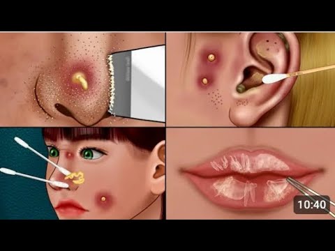 ASMR sehr befriedigende Pflegeanimation !!!! Durchdringende Reinigung, Nasensebum, Mundpflege ..